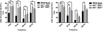 Hearing Loss in Id1−/−; Id3+/− and Id1+/−; Id3−/− Mice Is Associated With a High Incidence of Middle Ear Infection (Otitis Media)